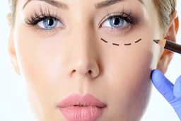 چند روش آسان و ارزان برای درمان گودی زیر چشم در خانه