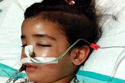 پایان تلخ شکنجه دختر 4 ساله توسط نامادری؛ آوا درگذشت
