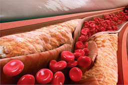 درمان خانگی کلسترول بالا