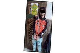 پسر صورت زخمی از نوجوانان زورگیری می‌کرد