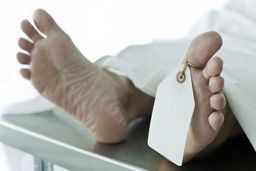 مرگ مرد دیالیزی به خاطر خونریزی