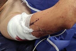 باز هم زورگیری از یک دانشجو/؛ این‌بار گرگان
