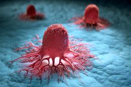 ارتباط مصرف الکل با بروز ۳ سرطان / پیشگیری تا ۵۰ درصدی از سرطان‌ها با غربالگری