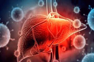 روش‌های درمان شایع کبد چرب