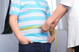 هشدار درباره روند افزایشی چاقی