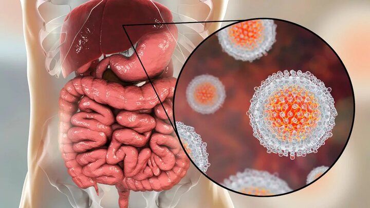 خبر مهم از بیماری هپاتیت