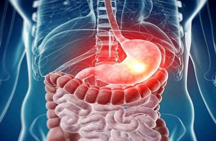 میوه‌ای که هم دوست دستگاه گوارش است هم باعث دردسرش