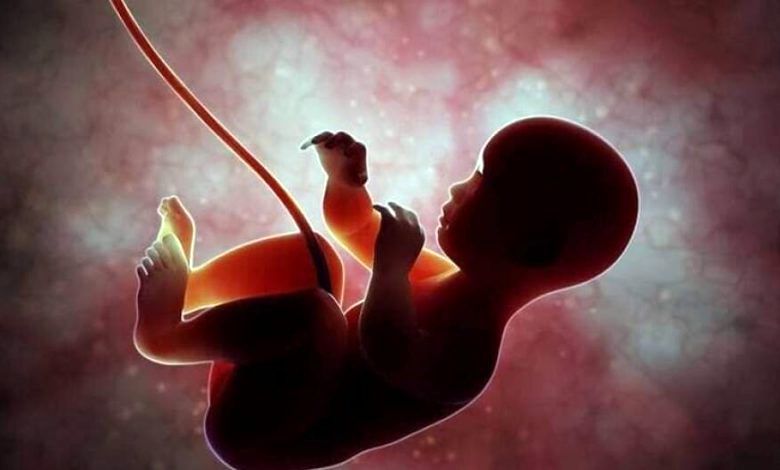 بیانیه وزارت بهداشت درباره سقط جنین مبتلا به سندروم داون