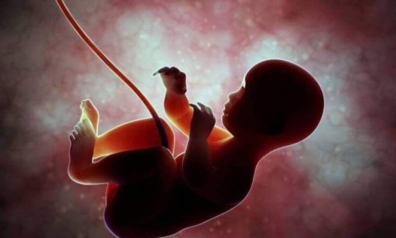 بیانیه وزارت بهداشت درباره سقط جنین مبتلا به سندروم داون
