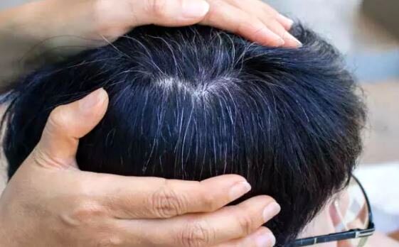 یافته‌ای جدید درباره سفید شدن مو