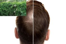 این گیاه می‌تواند کلید رشد مجدد مو باشد

